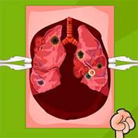 Игра Операция на лёгких онлайн